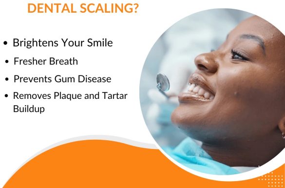 10 Tips That Will Make You Influential In price of smile makeover in India